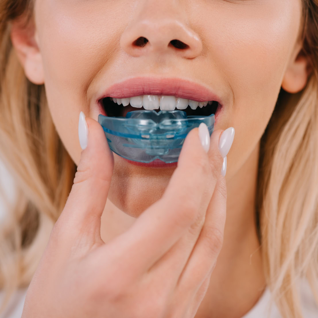 Custom mouthguard treatment at Refresh Dental Care Miranda
