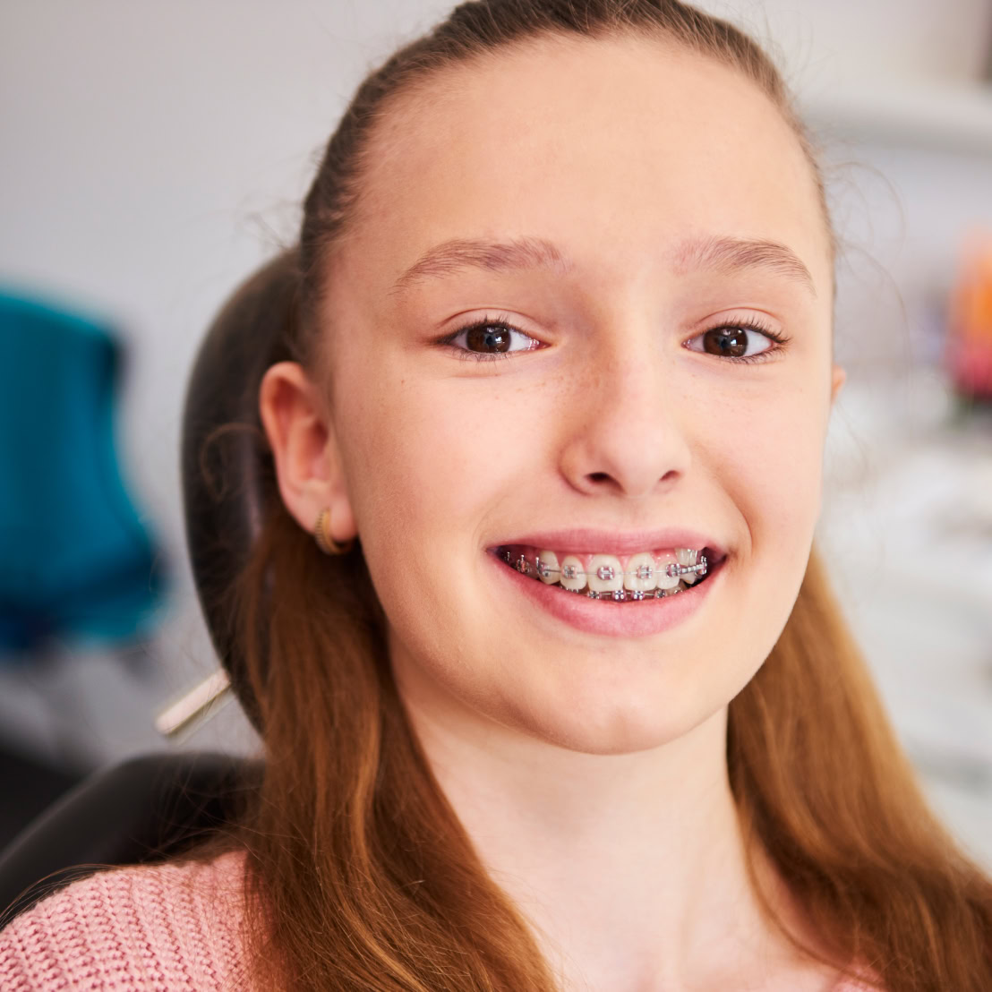 Dental braces treatment at Refresh Dental Care Miranda