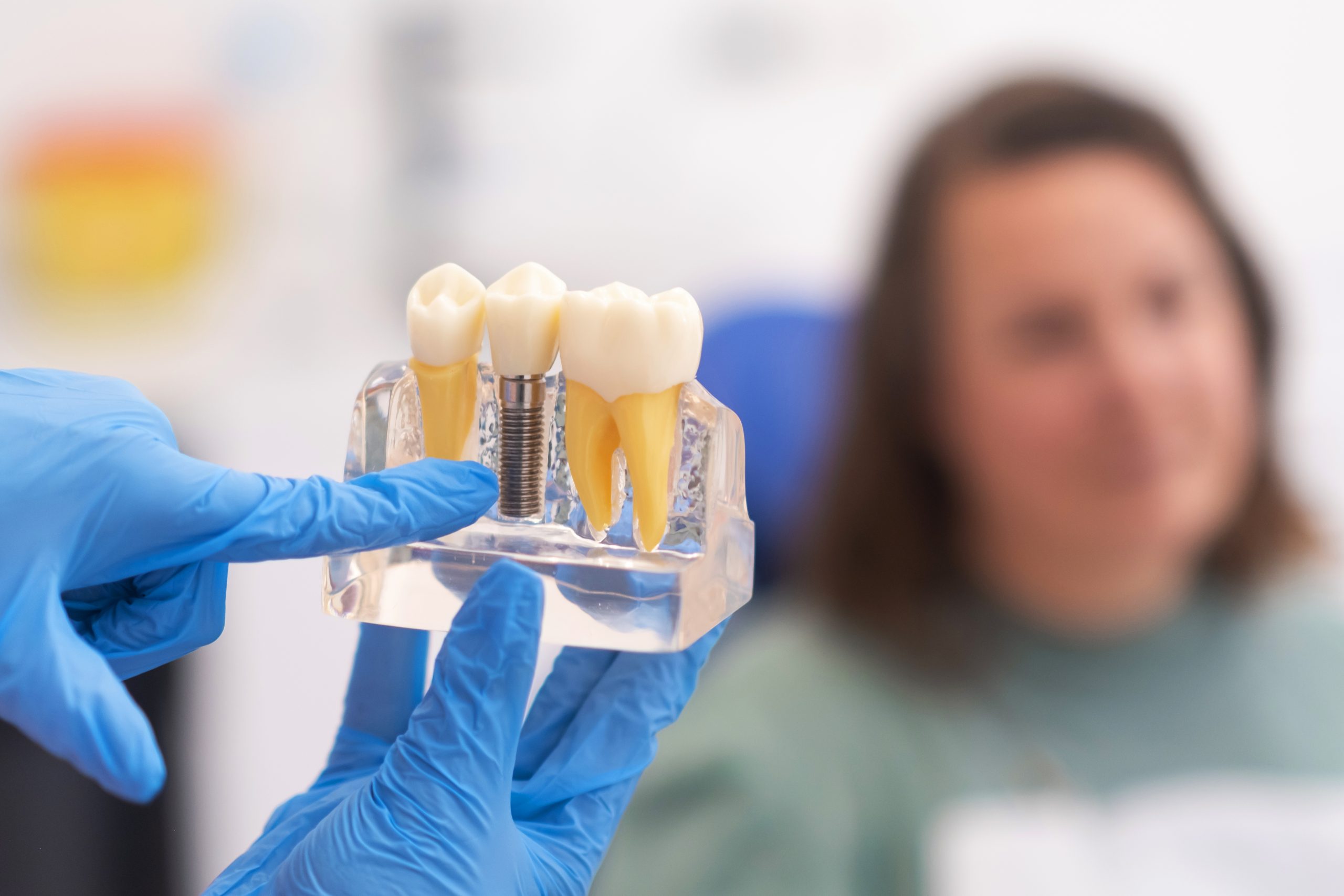 Everything You Need to Know About Dental Implant Costs