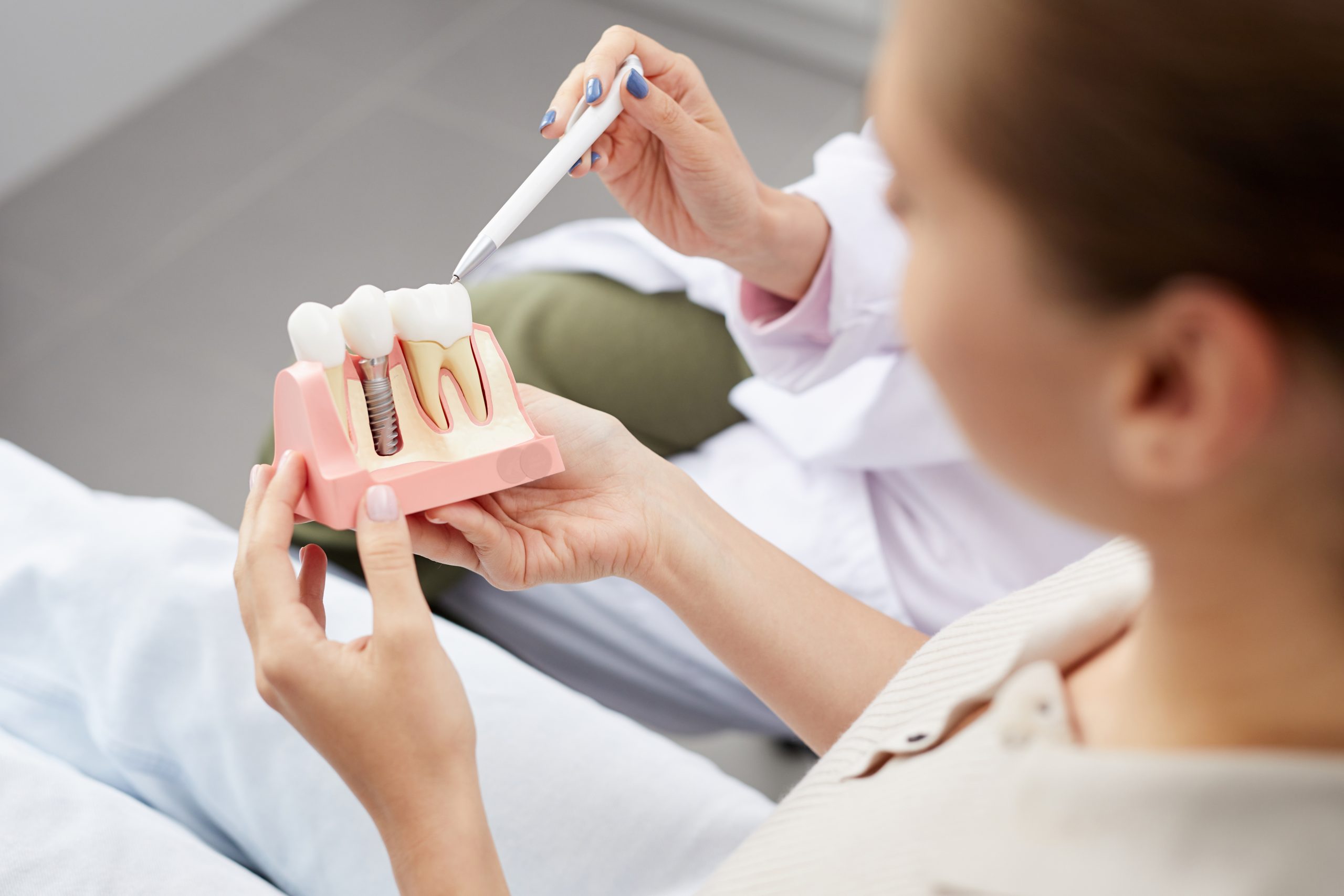 Maximising Your Benefits by Understanding Health Fund Cover for Dental Implants
