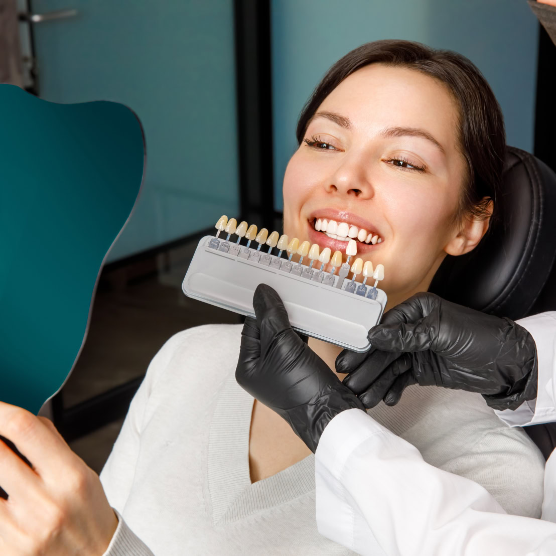Porcelain veneer treatment at Refresh Dental Care Miranda