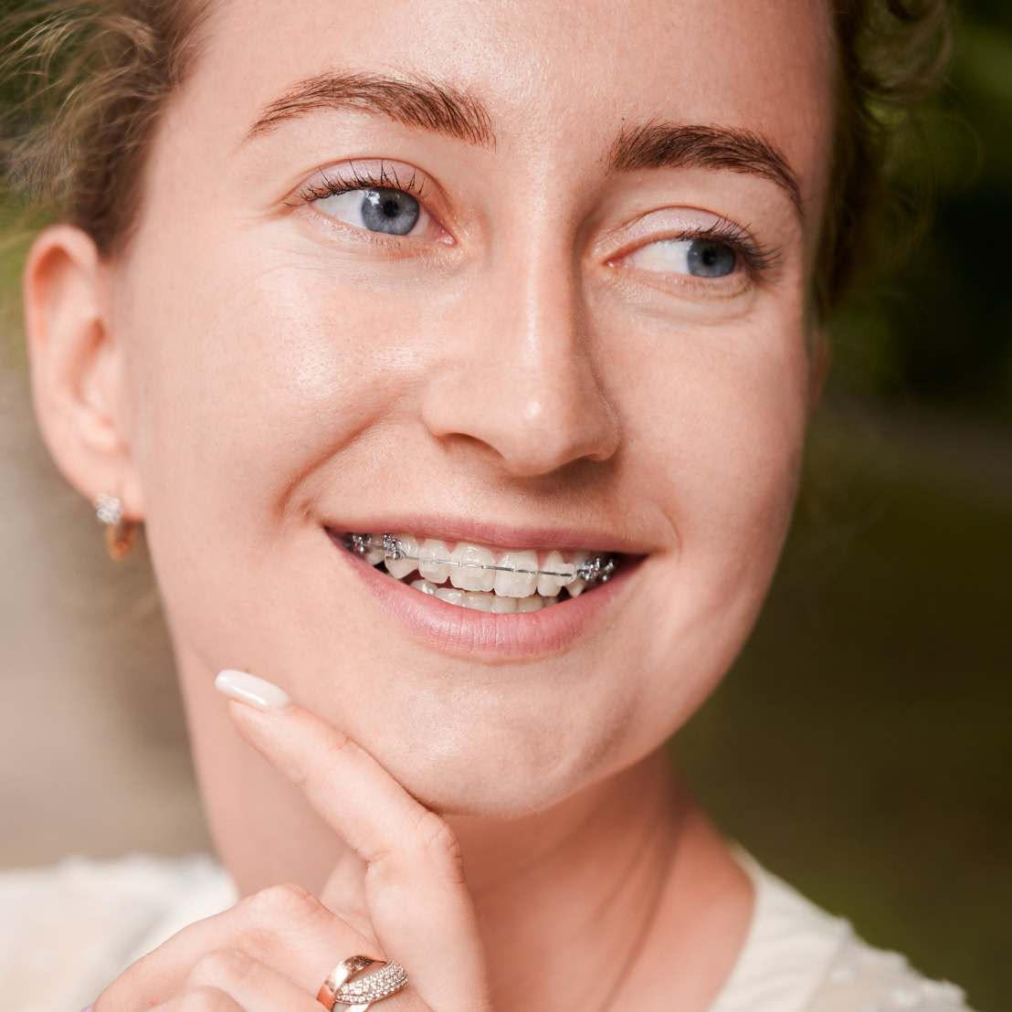 retainers candidate 1108x1108 - Refresh Dental Care Miranda