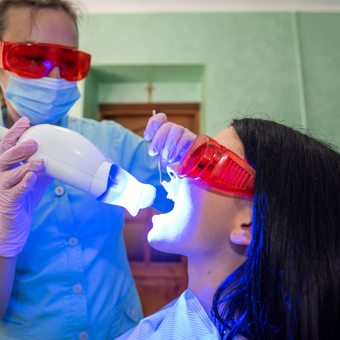 Teeth whitening treatment at Refresh Dental Care Miranda